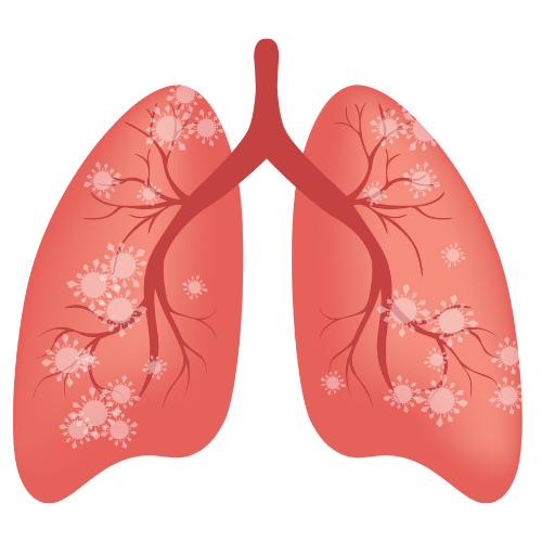 Pneumonia Care