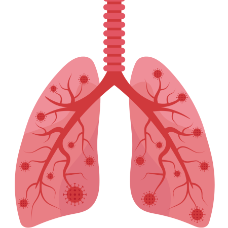 allergic Bronchitis