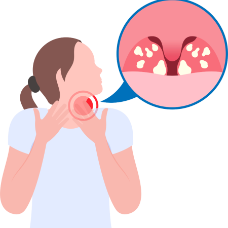 pneumonia